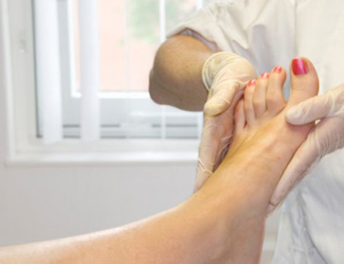 La pedicure e i diabetici importante è non tagliare